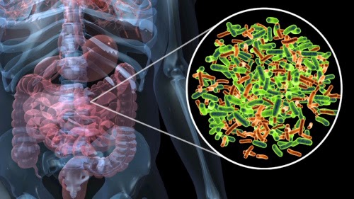 bacterial overgrowth in gut bacterial overgrowth in gut